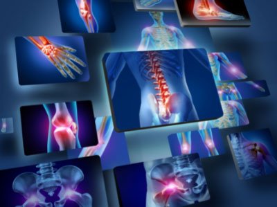 Orthopedics